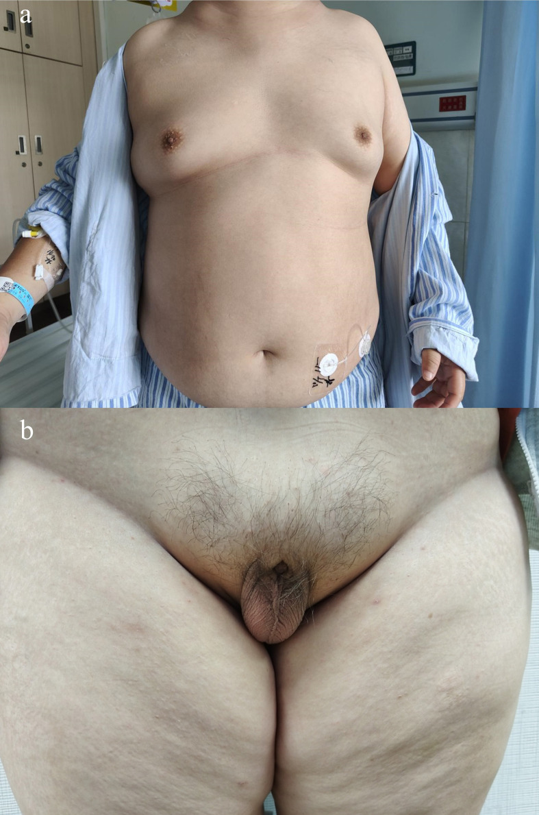 Figure 2