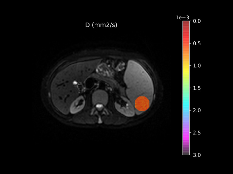 Figure 1