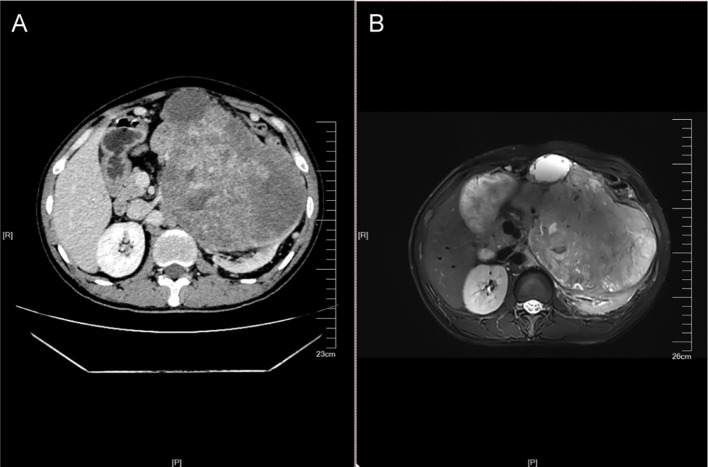 Figure 1