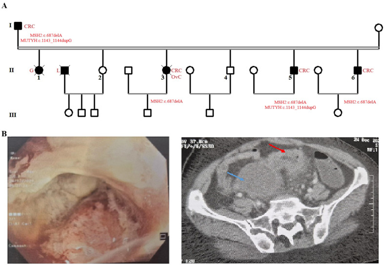 Figure 1