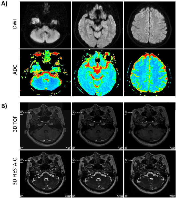 Figure 1