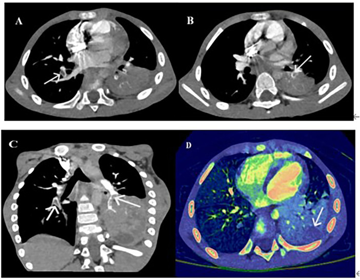Figure 1