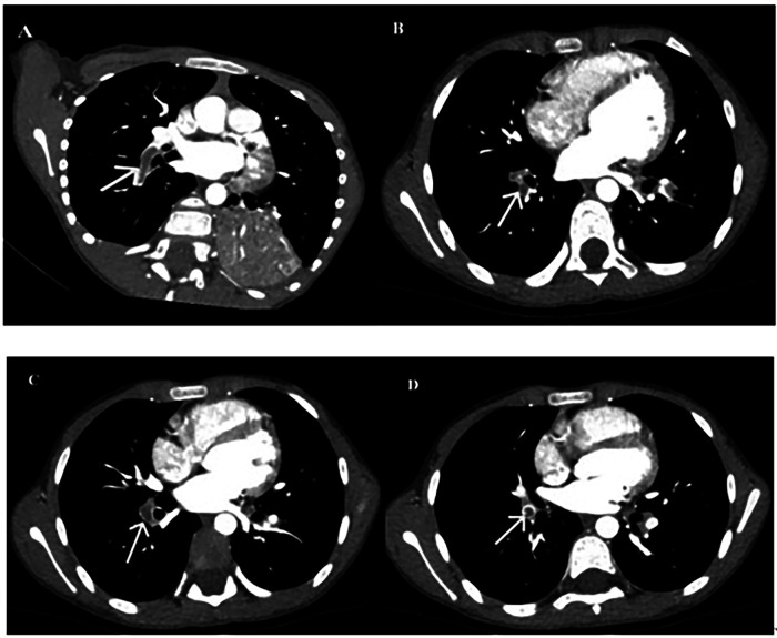 Figure 2
