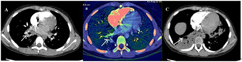 Figure 3