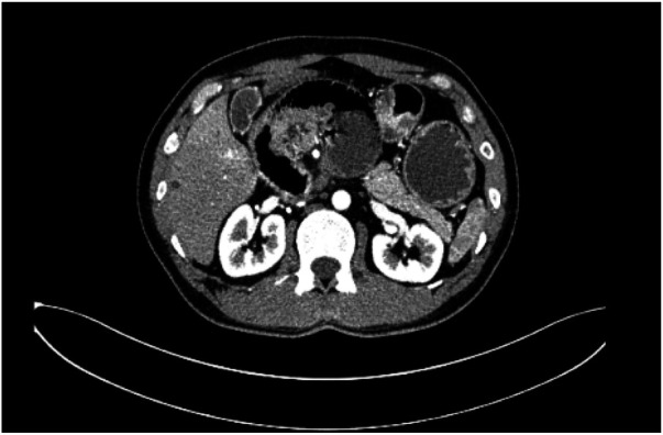 Figure 2