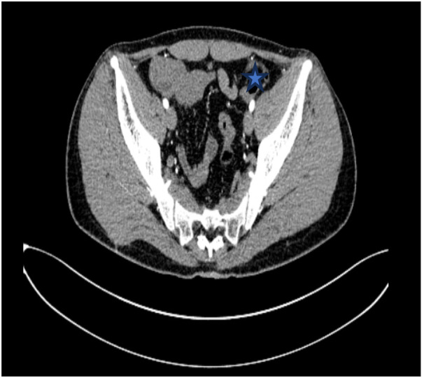 Figure 3