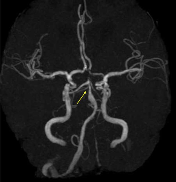 Figure 2