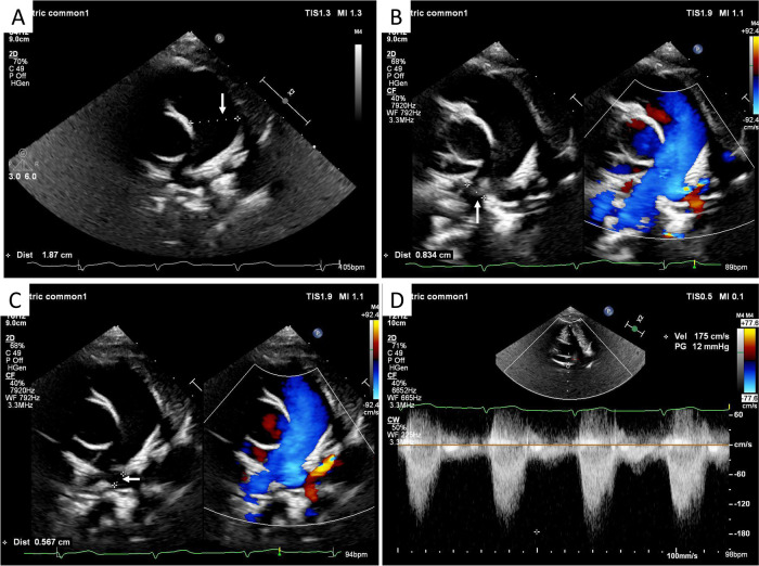 Figure 1