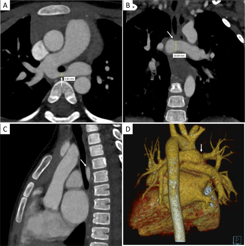 Figure 2