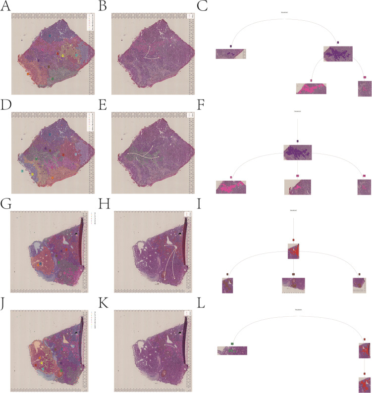 Figure 14