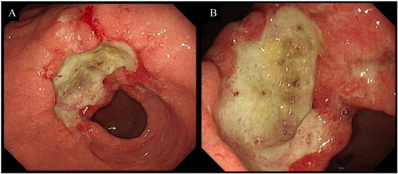 Figure 1