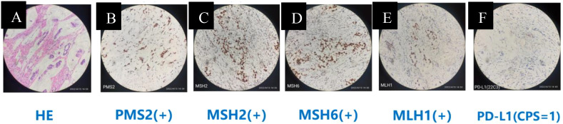 Figure 2