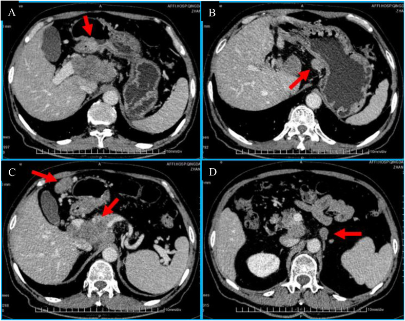 Figure 3