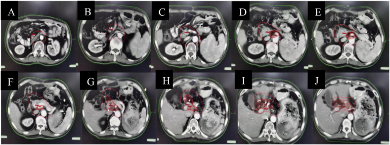 Figure 6