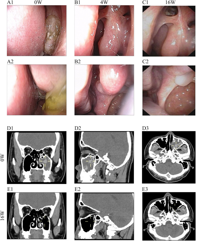 Figure 2