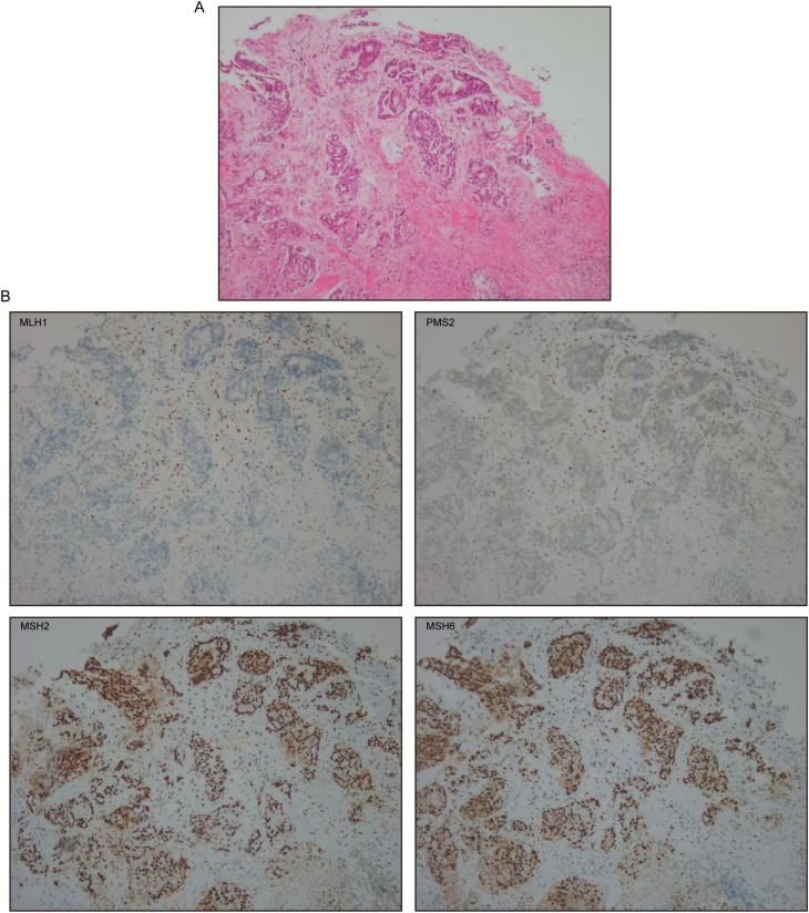 Figure 1