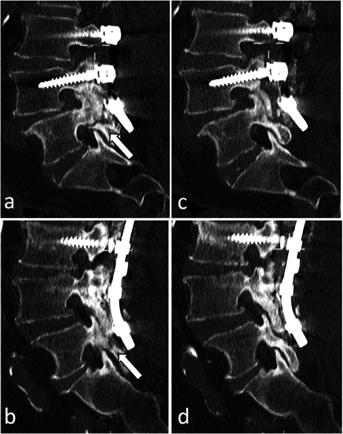 Figure 12