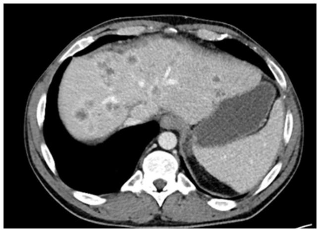 Figure 11