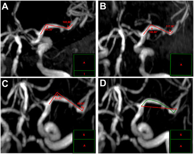 FIGURE 3