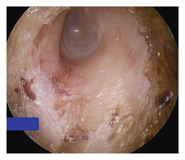 Figure FIGURE 3