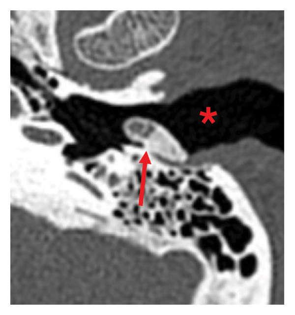 Figure FIGURE 1