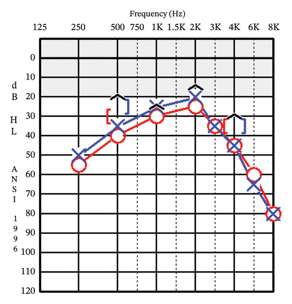 Figure FIGURE 2