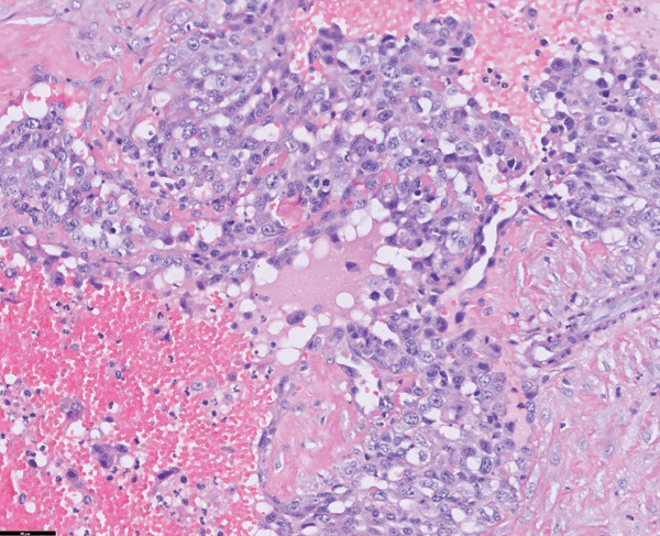 Figure 11