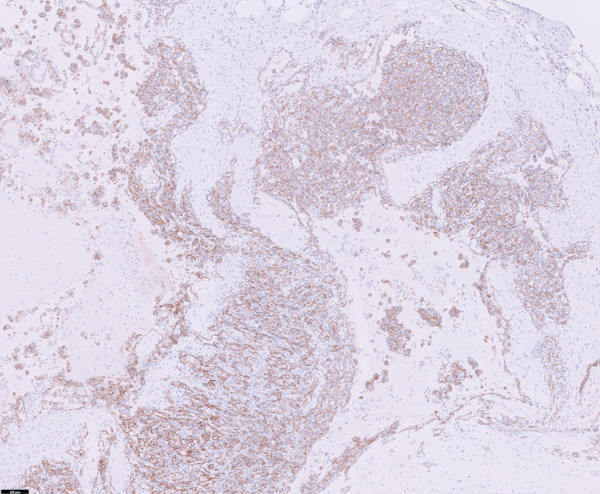 Figure 12