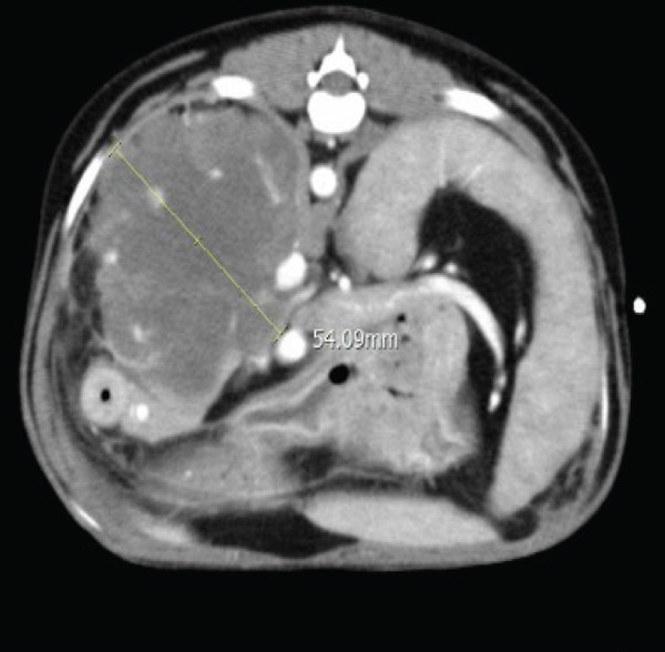 Figure 16