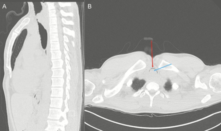 FIGURE 1