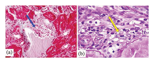 Figure FIGURE 2