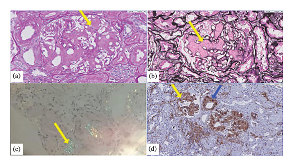Figure FIGURE 3