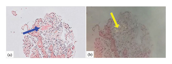 Figure FIGURE 4