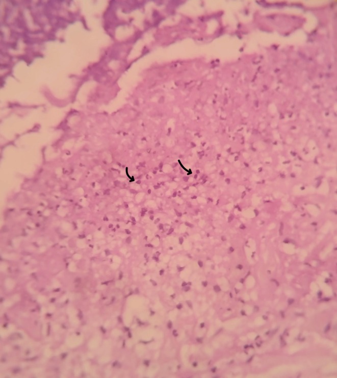 FIGURE 3