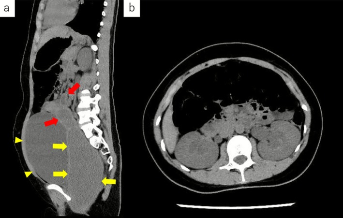 FIGURE 2