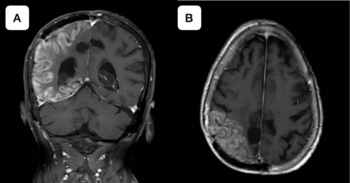 FIGURE 3