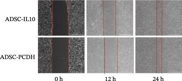 Figure 17