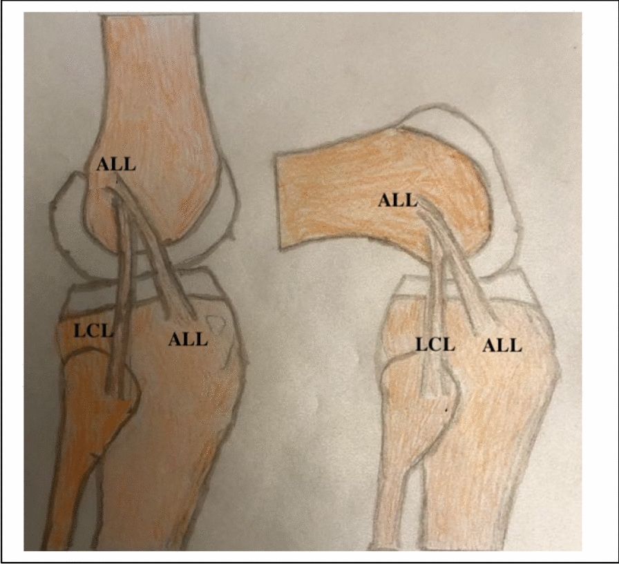 Fig. 11