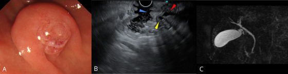 FIGURE 3