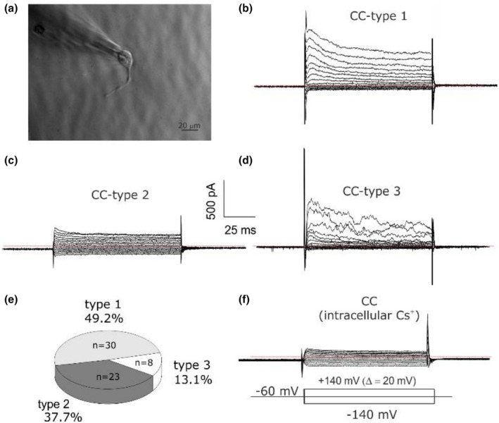 FIGURE 1