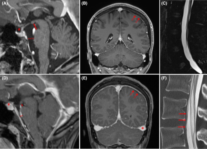 FIGURE 2