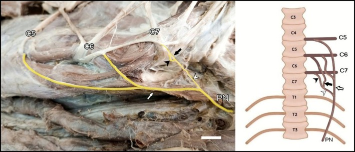FIGURE 4