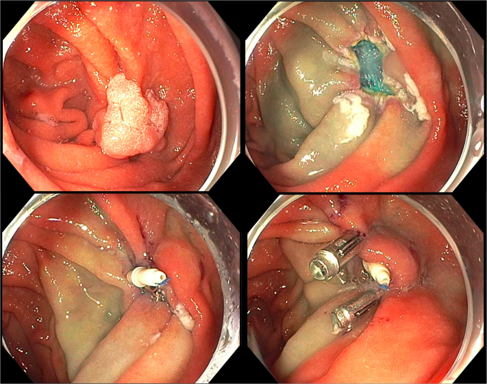 Figure 6