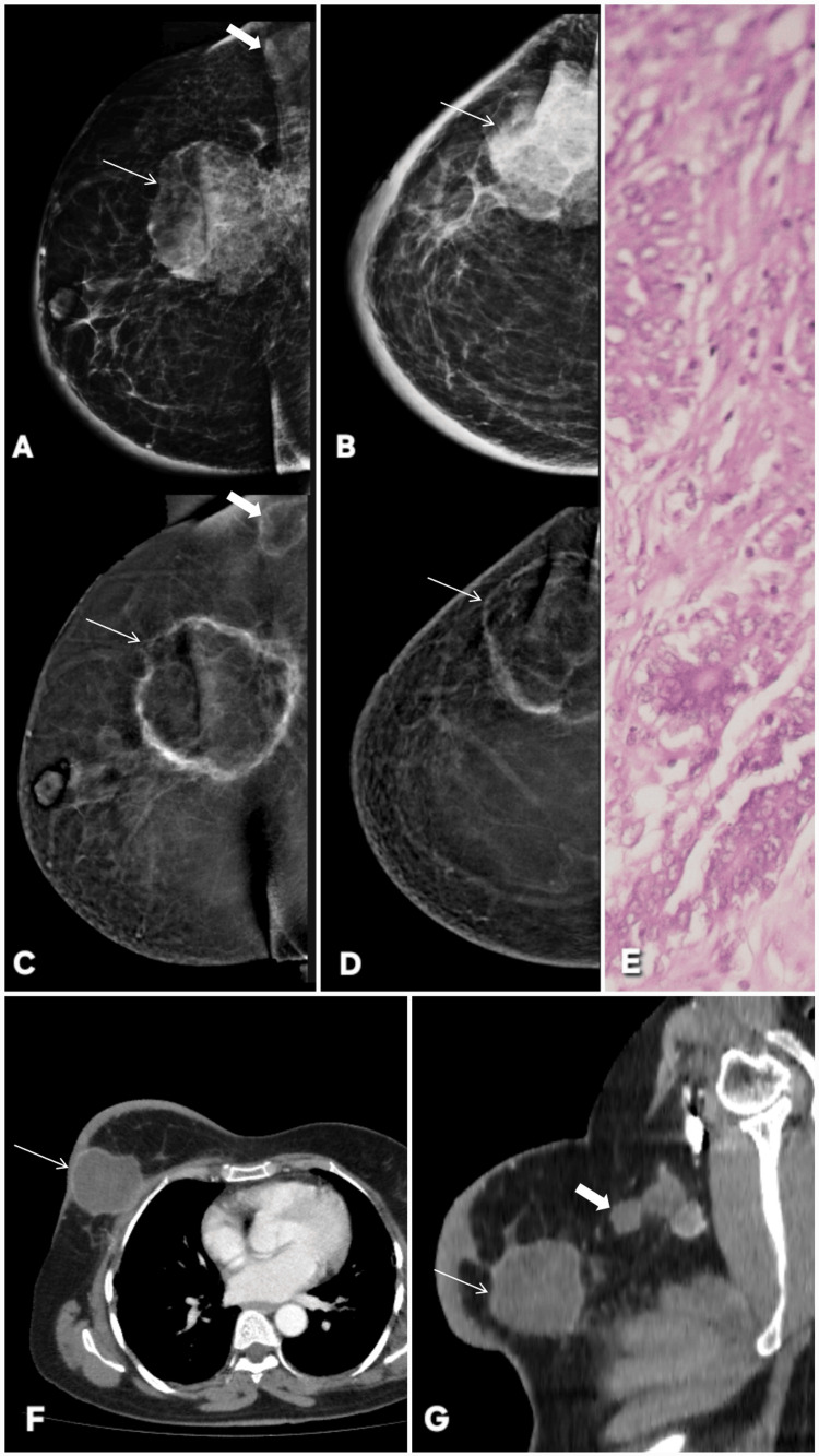 Figure 17