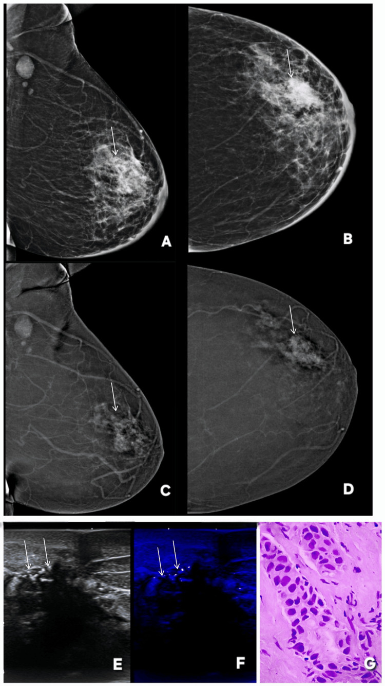 Figure 18