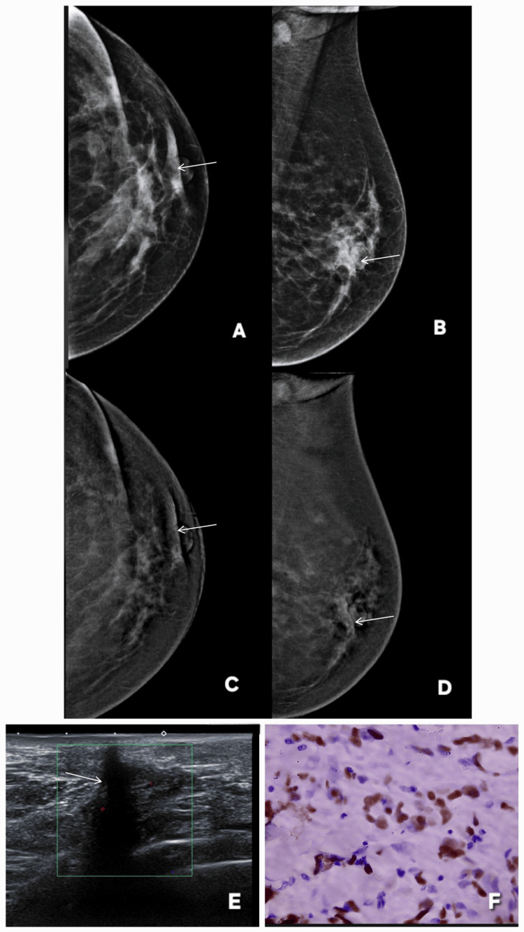 Figure 19