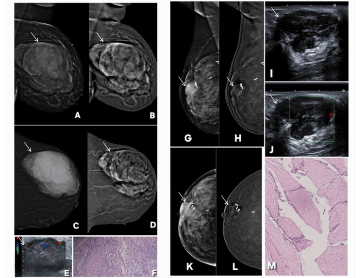 Figure 20