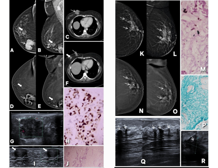 Figure 21