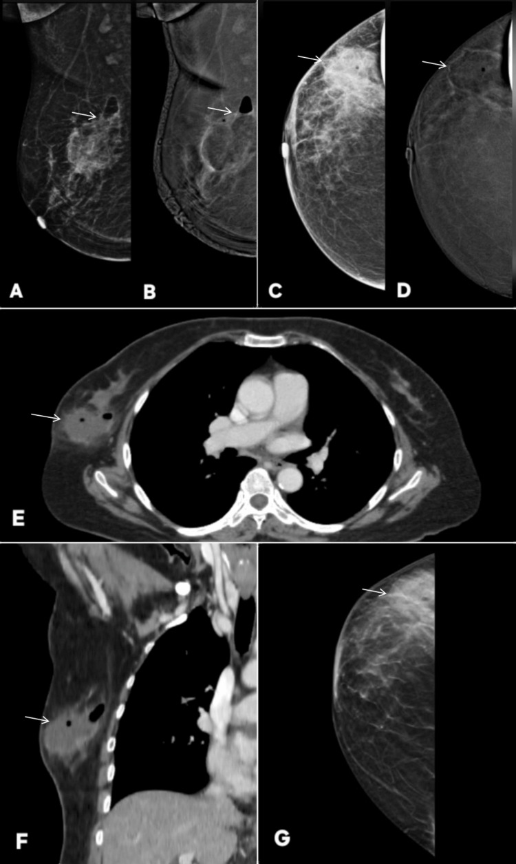 Figure 22