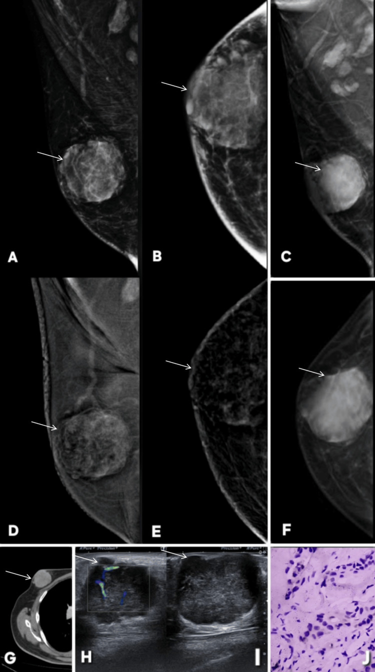 Figure 23